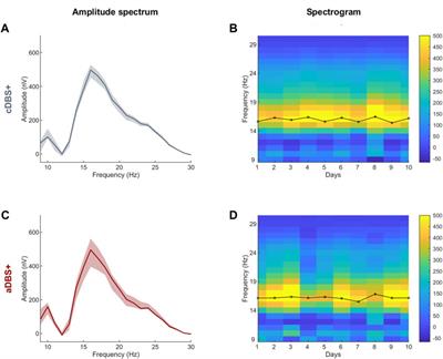 Case report: Improvement of gait with adaptive deep brain stimulation in a patient with Parkinson’s disease